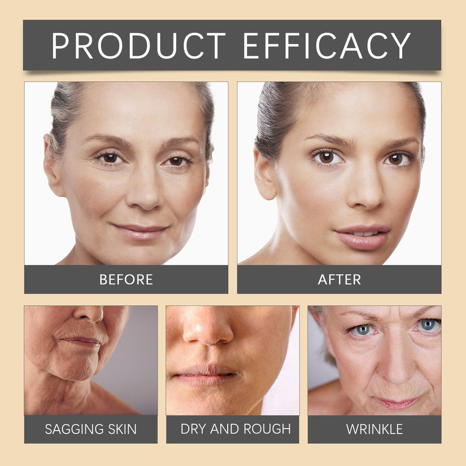Whitening Moisturizing Bee Venom Facial Care Cream